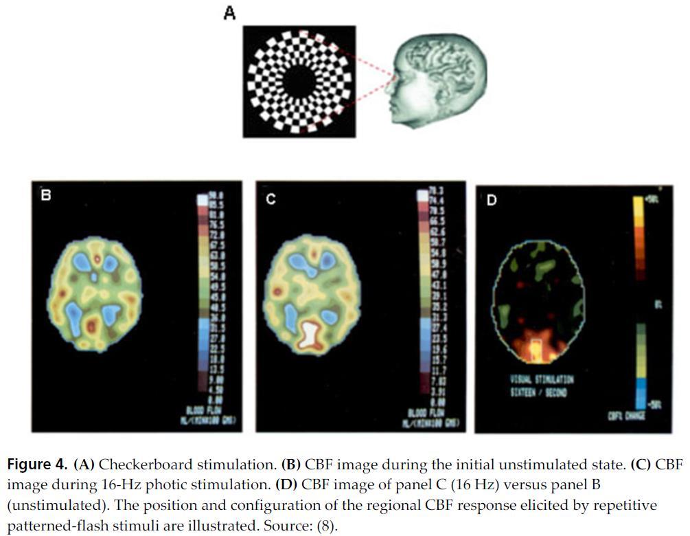 A neurovaszkuláris csatolás igazolása PET módszerrel Vízuális ingerlés emelkedett agyi vérátáramlást okoz az occipitalis kéregben;