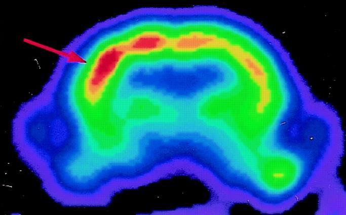 Neurovaszkuláris csatolás: kísérleti modellek Bajuszingerlés Elektromos