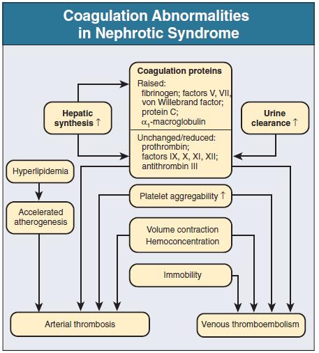 A nephrosis