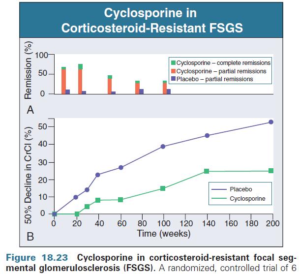 Az FSGS