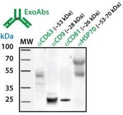 Előhívás Blot immunfestése