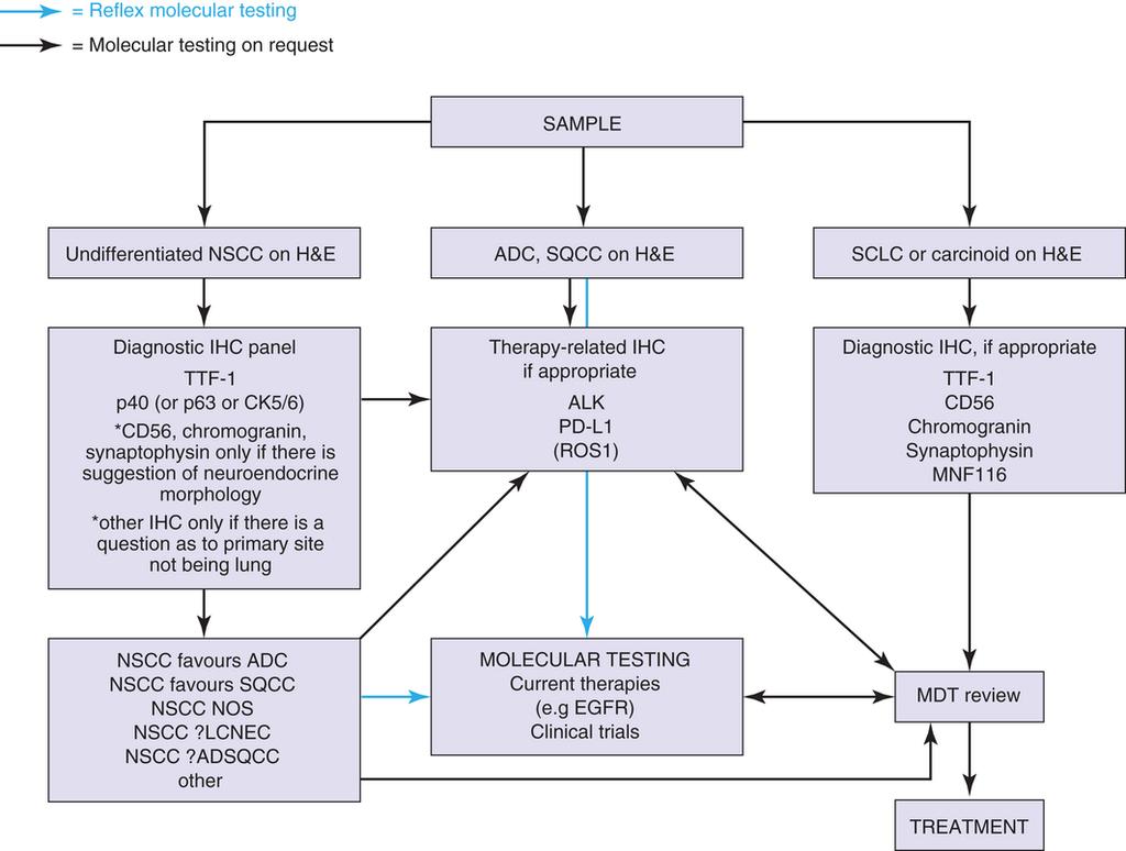 PD L1 testing for lung cancer in the UK: recognizing the challenges for implementation Histopathology Volume 69, Issue 2,