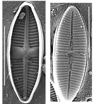 Frustulia crassinervia, és a Pinnularia subcapitata var. elongata. Valamennyi faj ritka a magyar flórában. Együttes előfordulásuk véletlenszerűen nem várható.