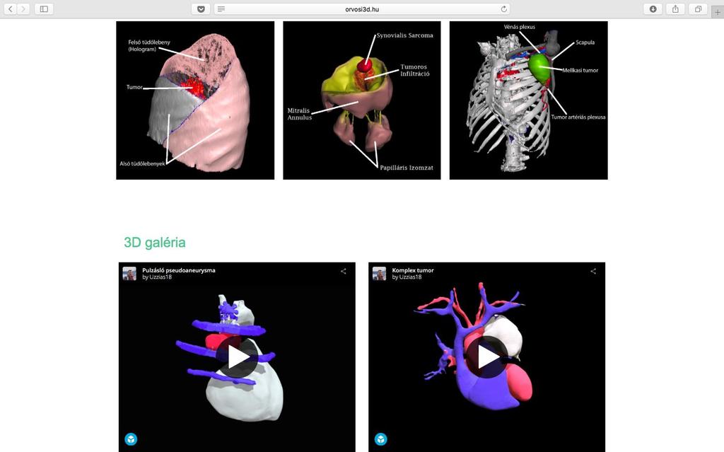 www.orvosi3d.hu Honlap az automatikus és gyorsabb tervezéshez Belépés Saját védett tartalom, mely az egyetemi szerver révén megefelel a betegjogi kívánalmaknak.