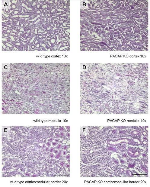 I/2. PACAP knockout egerek veséjének szövettani vizsgálata A vad és PACAP knockout egerek veséinek szövettani analízise során nem találtunk eltérést a vese szerkezetében (8. ábra).