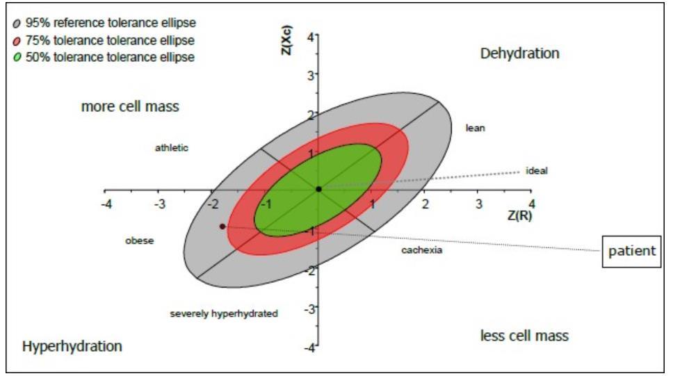 Bielektromos impedancia vektor analízis Segíti az