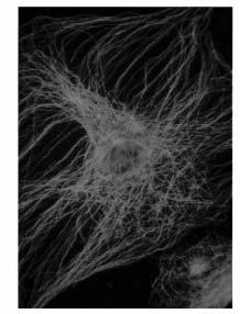 (rugalmassági modulus) -Termikus (entropikus) rugalmasság (perzisztencia hossz) ~7 nm vastag, hossza in vitro több