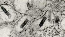 anthracis)(1877) Baromfi kolera (Bacillus