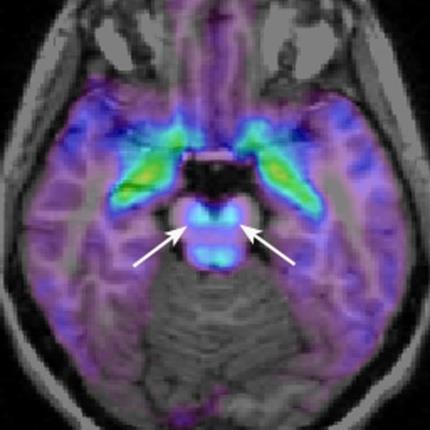 Limbikus rendszer (hippocampus, amygdala): memória, érzelmek 3.