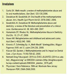 Publikáció Strasser-Solti F, Németh O, Kivovics P: Meth mouth