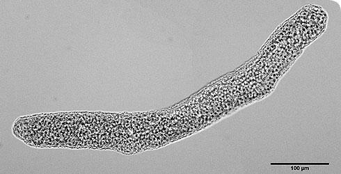 Nyálkaspórások (Myxozoa) 1300 faj Csalánsejtek a spórákon - leegyszerűsödött csalánzók?... Ősi bilateria? Paraziták (pl.