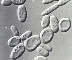 Dikarya klád - Magpáros állapot plazmogámia után Ascomycota