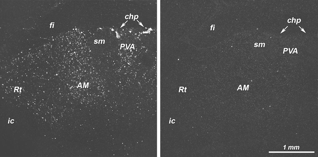 SPECIFICITY OF TGFbeta3 mrna LABELING: THE ABSENCE OF SIGNAL