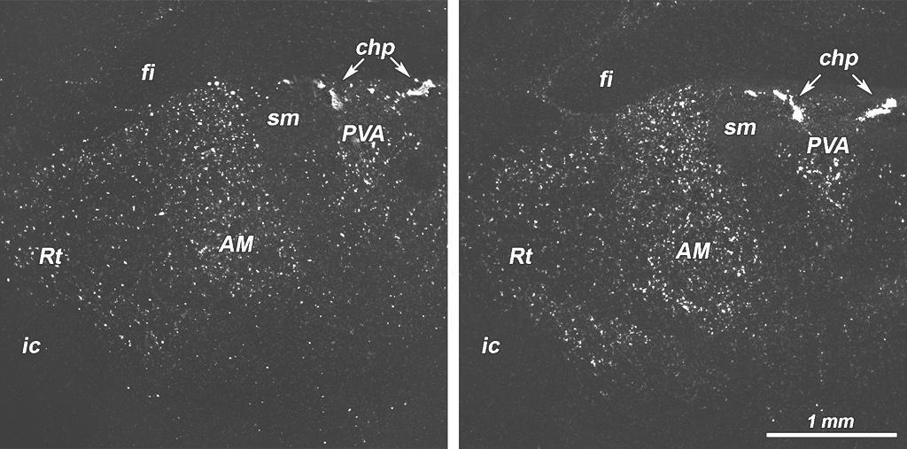 DISTRIBUTION OF TGFbeta-3 mrna IN THE THALAMUS WITH 2