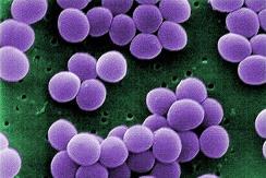 Escherichia coli és Pseudomonas aeruginosa baktériumtörzsek,