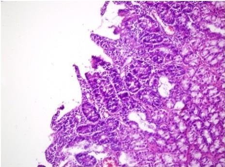 Güneş AE ve ark. Şekil 1. Kontrol grubunda künt hasar verilmiş duodenal doku kesitleri (H-E X400). Şekil 2.