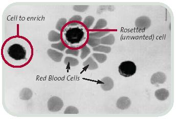 Komplement mediált lízis (negaov és poziov szeparáció) ellenanyagok komplement LÍZIS (negaov szeparáció) kitapasztott ellenanyagok (A vörösvérsejtek enyhén hipotóniás ammónium- klorid pufferben