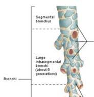 Aorta stenosis: Aorta systolés zörej Bulbus aortae Aorta Jobb pitvar Tricuspidalis Jobb kamra 1.