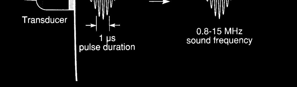 =, 0,00043 0 transzduer: adó és vevő egyben 6 tüdő 400 5,9 650 0,6 0 6 időbeli szétválasztás folyamatos hullám helyett impulzusok zsír 95 0,5 470,4 0 6 0,63 víz, 0 C