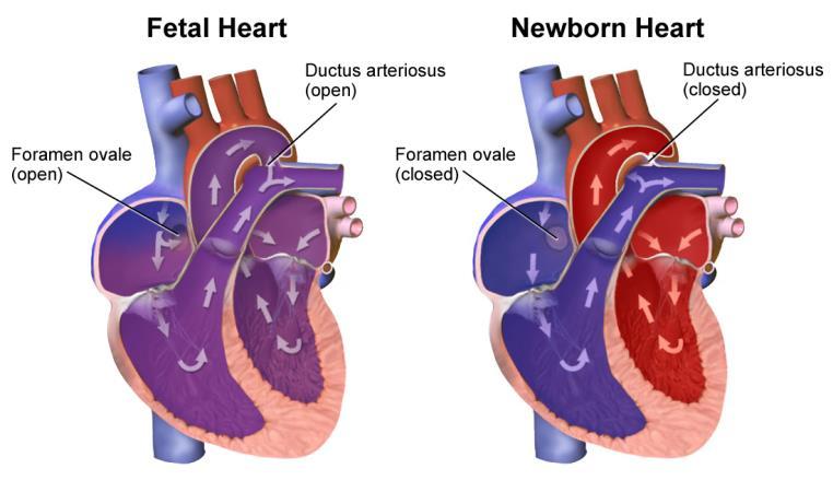 Botalli Foramen ovale Ductus