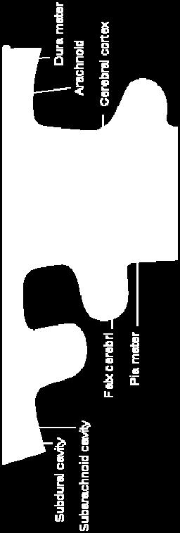 normálnyomású hydrocephalus) CSF