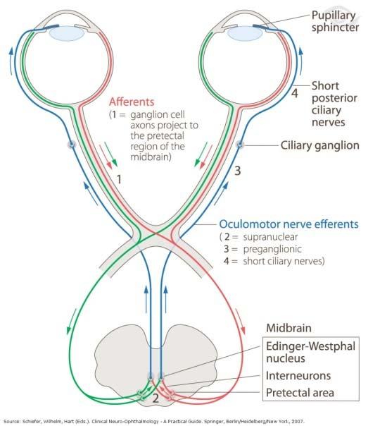 léziók Horner szindróma: ptosis, miosis, enophthalmus 1. neuron: pregangl. : HTH GV.