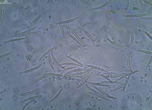 figyelni (8. kép). Vizsgálataink során a Fusarium sp. ivaros alakjának, a Gibberella sp.-nek megjelenését is bizonyítottuk. A Gibberella sp.