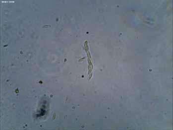 vizsgálata során Fusarium, Gibberella és Rhizoctonia gombanemzetségek fajait azonosítottuk.