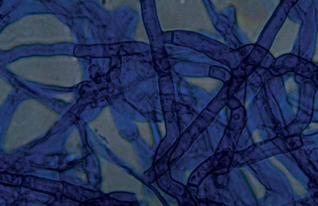 syn.: Pseudocercosporella herpotrichoides) okozta tünetekkel. Véleményünk szerint a szakmai közvéleményben a tüneti hasonlóság indukálta a szártörő gomba feltételezett jelenlétét.