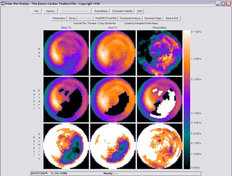 Polar map-ek a normal