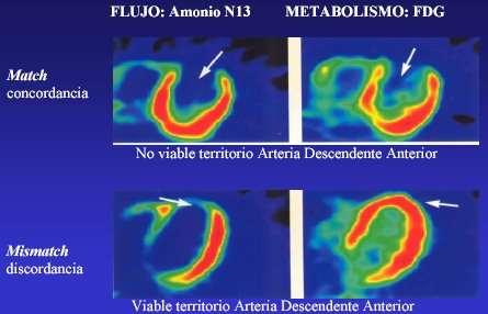 viabilis myocardium