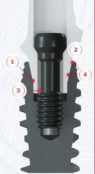 Improves performance across every indication Unique prosthetic connection design has benefits for both clinicians and laboratories SE