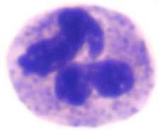 Celluláris folyamatok - sejtek Gyulladásos sejtek - leukocyták Neutrophil granulocyta leggyakoribb leukocyta 2,5-7,5 10 9 /l a vérben elsőként halmozódnak fel akut gyulladás fő sejtje phagocyták,