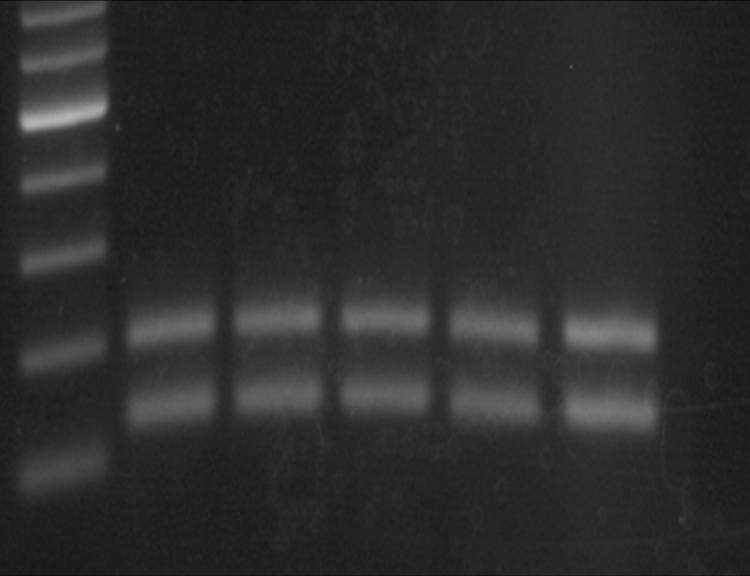 cmvtestr: TATCCACGCCCATTGATGTA A PCR reakció eredményeként egy 163 bp hosszúságú fragmentet kaptam, valamint a már fent jellemzett 215bp hosszúságú szakaszt. A 6.