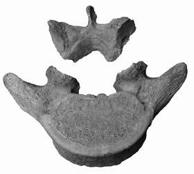 A spondylolysis (5. ábra) előfordulása 176 egyénnél volt vizsgálható. A felnőttkort el nem érők esetében az 62 vizsgálható esetből mindössze egyszer fordult elő (1,61%; 6. táblázat).