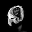 Az MRI képek jellemzői súlyozási eljárások: T1: strukturális elemzésekhez - a szürkeállomány sötétebb szürke, a fehérállomány világosabb, esetleg fehér, és a liquor fekete.
