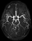Strukturális MRI vizsgálat Funkcionális MRI http://hu.wikipedia.org/wiki/f%c3%a1jl:user-fastfission-brain.gif Az agyi képalkotás módszere.