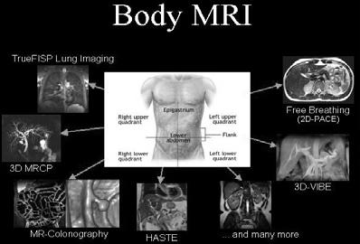 Az fmri és az EEG fmri: magas térbeli, de kicsi időbeli felbontás (néhány s). EEG: magas időbeli (ms), de alacsony térbeli felbontás.