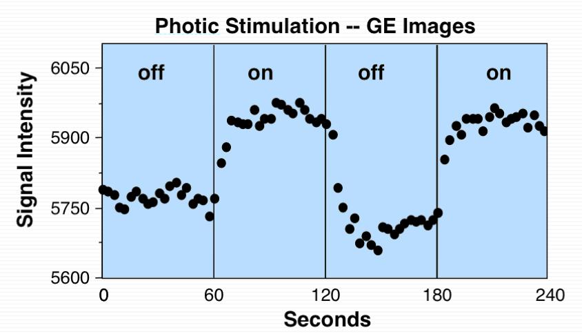 Példa fmri Signal increases relatively slowly (several seconds), and returns to baseline slowly. No exogenous contrast needed.