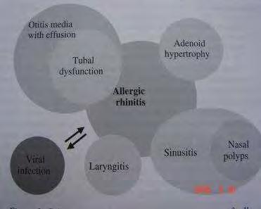 Rhinosinusitis: az antibiotikum