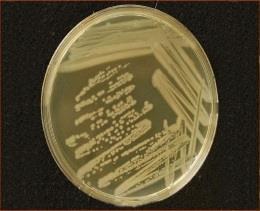 mikroelemek Felvehető (N,P,K, tápelemek (10- Mg,Mn,Fe,B,Zn,Cu,Mo) féle) Pseudomonas baktériumok Oxigén, bioszén (0,5%, 14 kg/ha), táp-elemek!