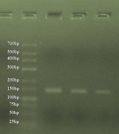 Reagens Mennyiség/reakció 2X Mix 12,5µl 10X Coral Load 2,5µl Forward primer 1µl Reverse primer 1µl DNS minta 5µl Desztillált víz 3µl Végtérfogat: 25µl 4.Táblázat - PCR mix összeállítása A 4.