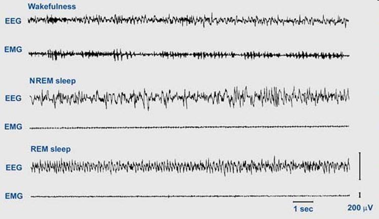 Az alvás szerkezete, stádiumai Alvásvizsgálatok, alvásbeosztás EEG-t és elektromiogramot (EMG)-t mérnek, esetenként elektrookulogramot (EOG) is az adatokból