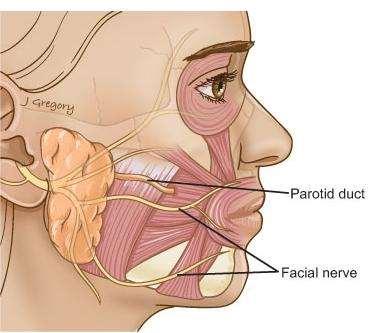 Parotis állomány Felületes, mély és járulékos lebenyek Parotis (Stenon-vezeték) Facialis ideg (stylomastoid