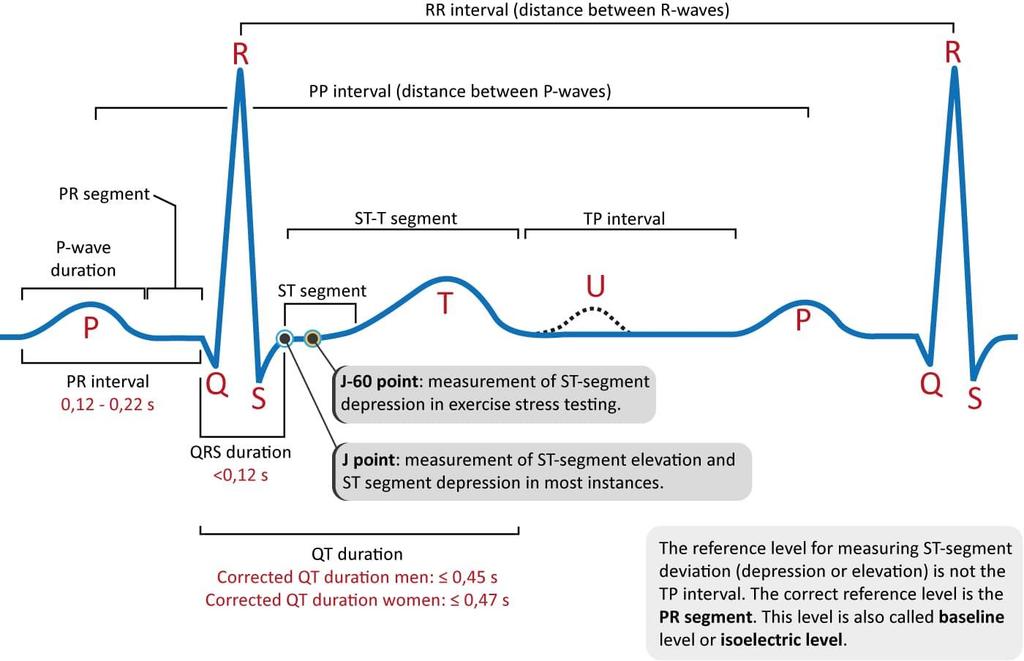 Magzati EKG vizsgálat jelentősége, eddigi módszerei, eredménye 14 9. ábra Az EKG görbe normál morfológiája. Hullámok, szakaszok és intervallumok definíció szerinti felosztása. https://ecgwaves.