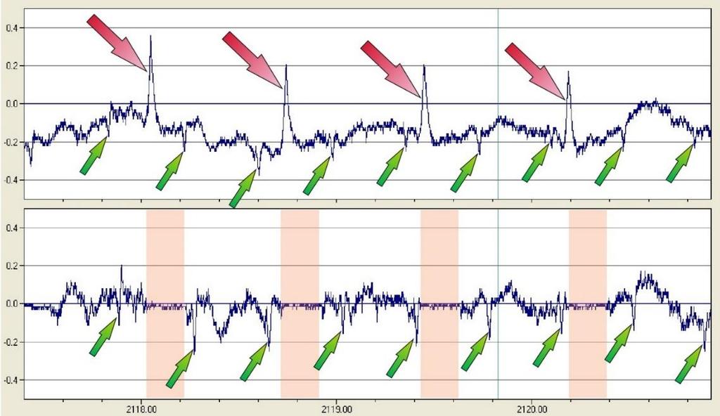 Módszer és beteganyag 26 15. ábra - Hardveres jelfeldolgozás, mely során a vevő egység az anyai EKG R hullámának automatikus felismerését követően a magzati (abdominális) felvételen kikapuzza azokat.