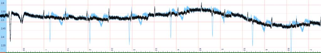 Az általunk készített csúcsdetektor automatikusan felismeri az anyai EKG R hullámait, és trigger eseményként jelöli azokat.