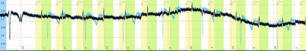 Az esetünkben alkalmazott nagy mintavételi frekvencia miatt (5KHz), az anyai jel igen nagy felbontású. Az abszcissza mentén csaknem 3000 különböző pontból áll.