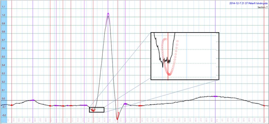 Eredmények 62 A determinánst átírva: (P x, P y ) = ( (x 1y 2 y 1 x 2 )(x 3 x 4 ) (x 1 x 2 )(x 3 y 4 y 3 x 4 ) (x 1 x 2 )(y 3 y 4 ) (y 1 y 2 )(x 3 x 4 ) megkapjuk a metszéspontot.