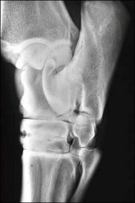 Lovak osteoarthritise Akár a sántaságok 30 60%-át okozza (Alwan, 1991;National Animal Health Monitoring Systems, 2000; Caron and Genovese,